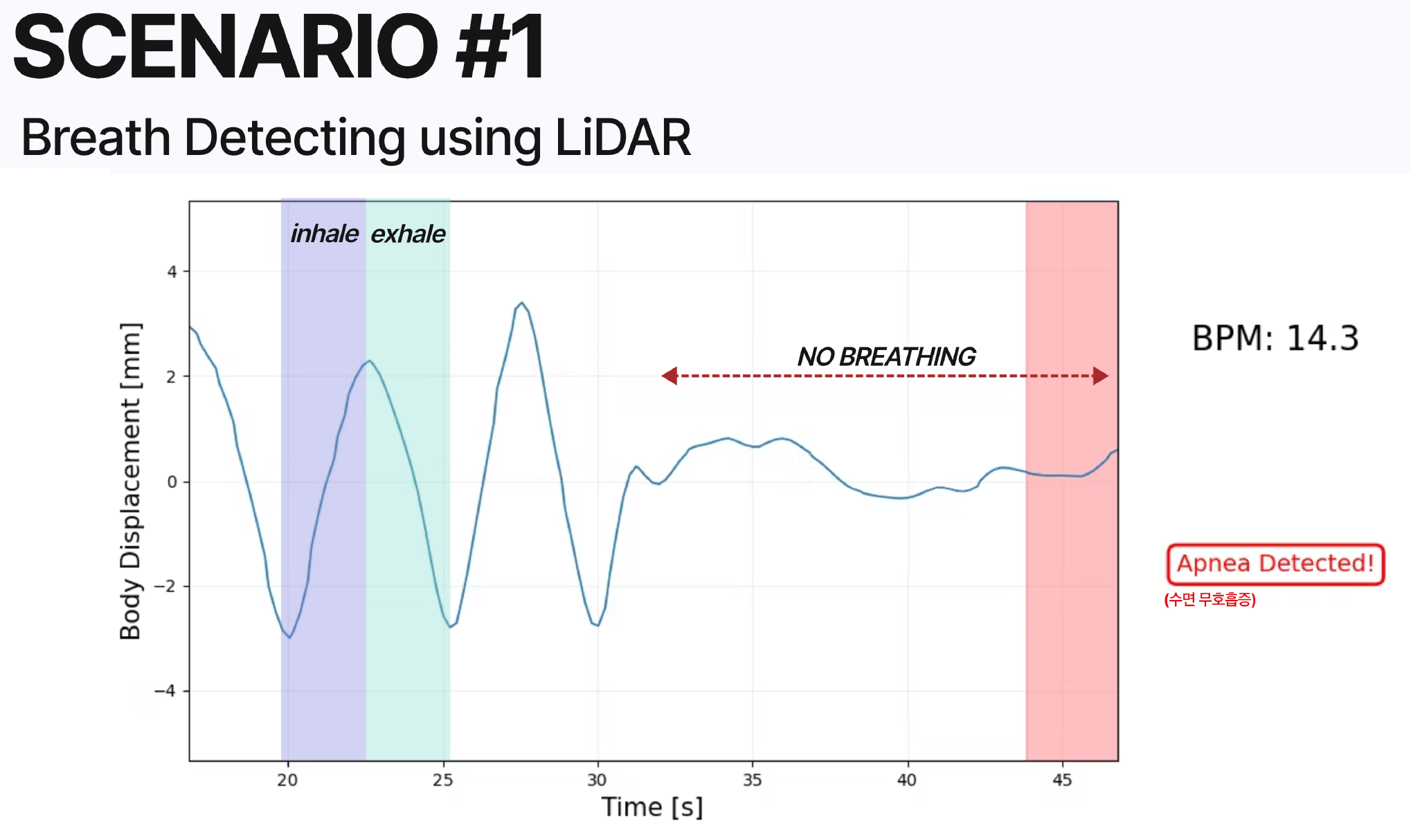 Breath detection and apnea detection using LiDAR